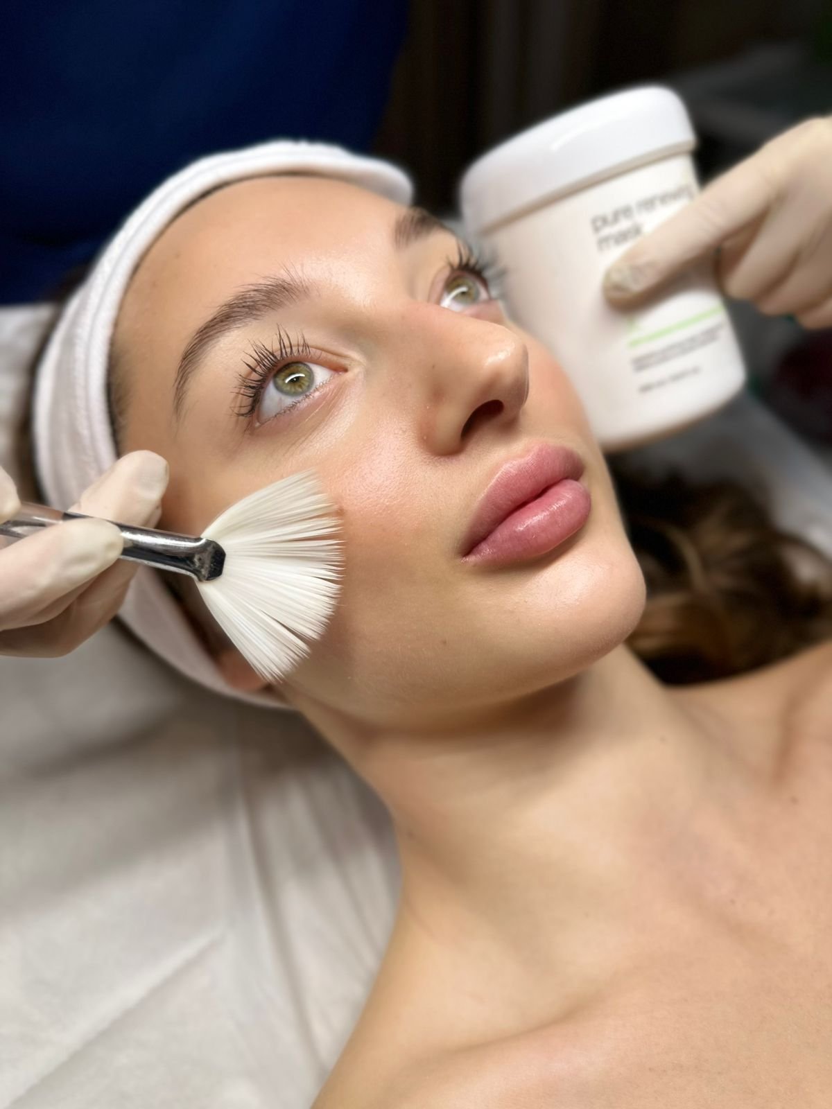 Θεραπείες Αντιμετώπισης Ακμής